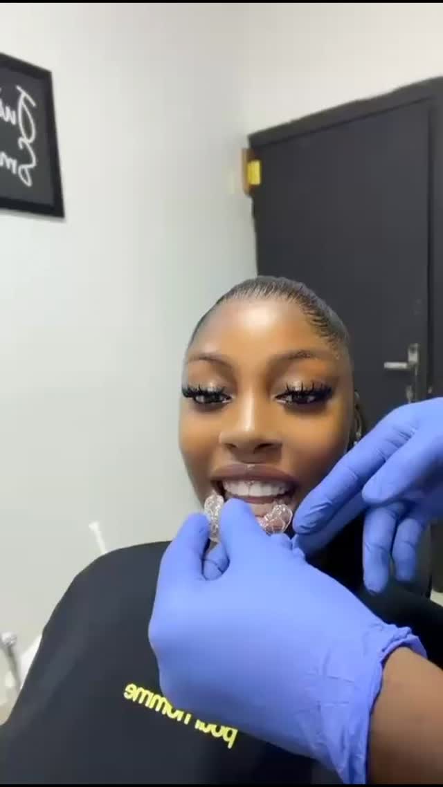 Patient holding a clear aligner tray in a dental clinic
