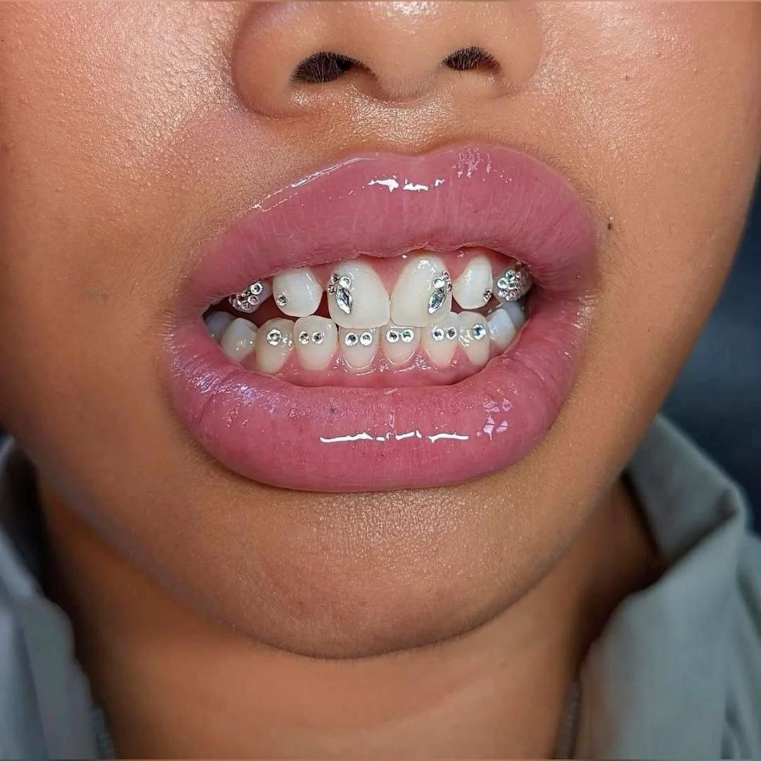 Dentist holding a ceramic dental crown beside a tooth model