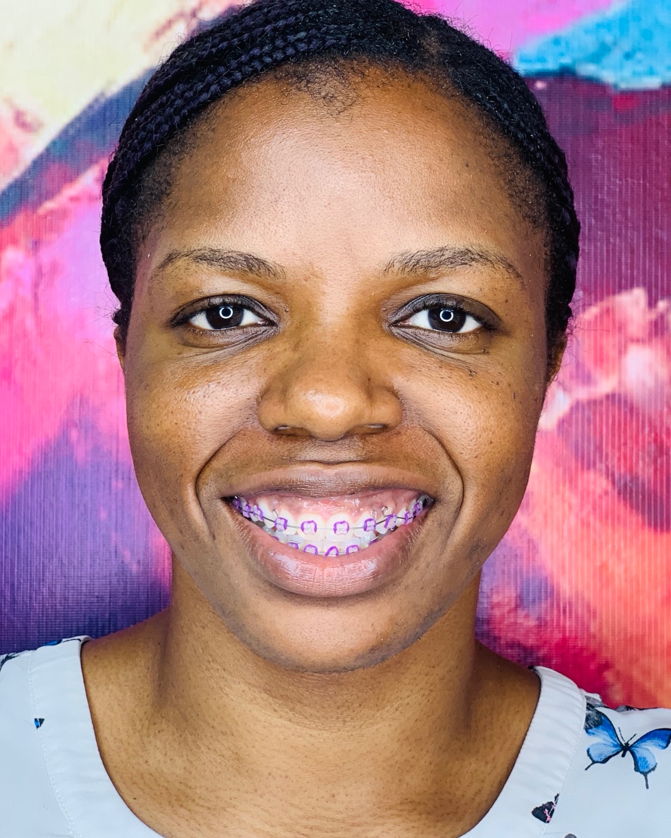 Patient smiling with fixed orthodontic braces