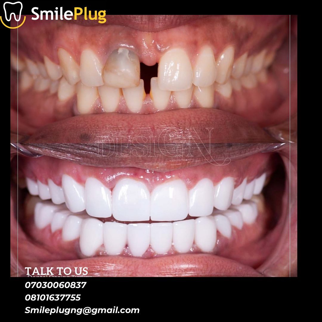 Nine-month clear aligner course · Abuja
